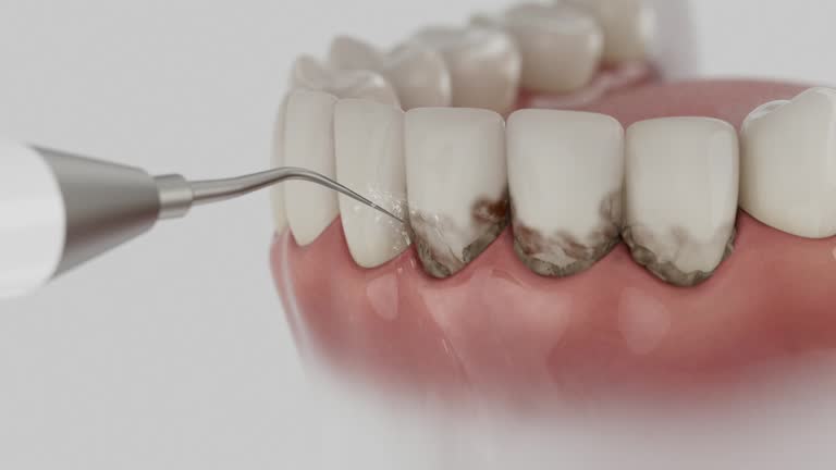 Trusted Teeth Cleaning And Checkup service in Ferron, UT - Dentist Open Now